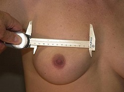 breast assesment